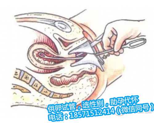 哈尔滨卵巢早衰供卵服务,广东妇幼保健院试管婴儿医生评价